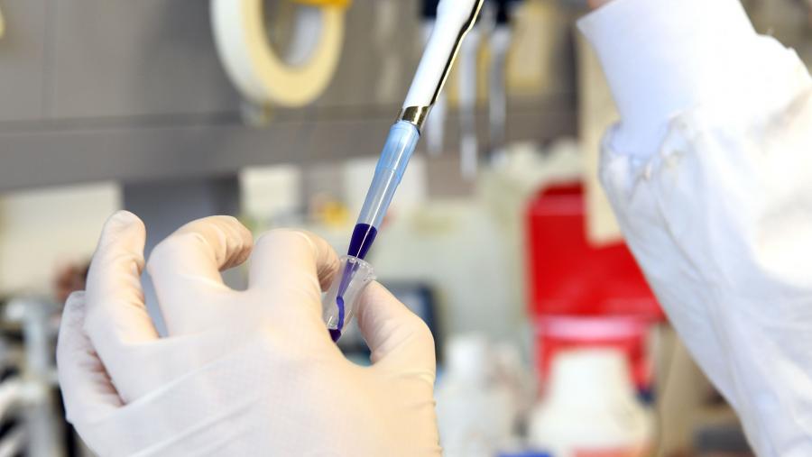 Os investigadores conclúen que os resultados proporcionan información nova sobre os cambios da fosforilación plaquetaria relacionados coa obesidade. FOTO: Santi Alvite Os investigadores conclúen que os resultados proporcionan información nova sobre os cambios da fosforilación plaquetaria relacionados coa obesidade. FOTO: Santi Alvite