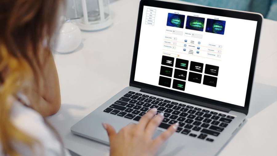 Nun test de uso realizado por profesionais da Odontoloxía, estes recoñeceron que o software DenTiUS Plaque podería ser unha ferramenta moi útil para a cuantificación dos niveis de placa dental Nun test de uso realizado por profesionais da Odontoloxía, estes recoñeceron que o software DenTiUS Plaque podería ser unha ferramenta moi útil para a cuantificación dos niveis de placa dental