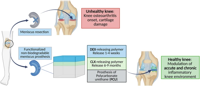 Publication: Blanco, A.F., Lou, G., Pensado-López, A. et al. Controlled co-delivery of anti-inflammatory drugs from bilayer polymer films coating a meniscus implant. Drug Deliv. and Transl. Res. (2025). https://doi.org/10.1007/s13346-025-01942-5