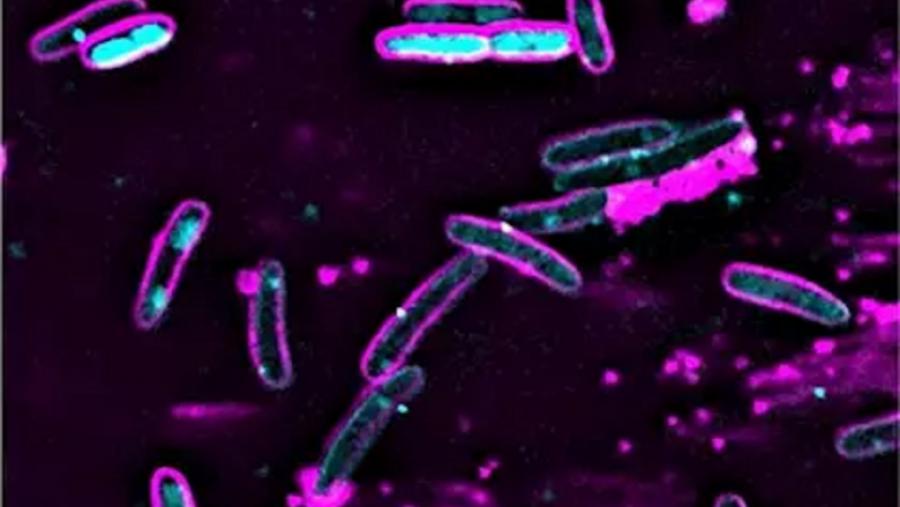 Células da bactera 'E. coli' sobre as que se realizou o estudo das pipolinas Células da bactera 'E. coli' sobre as que se realizou o estudo das pipolinas
