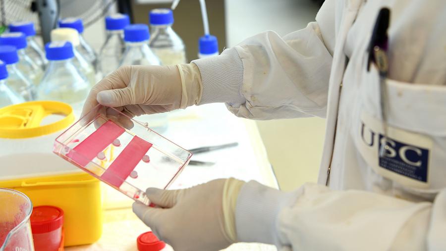 Estas iniciativas exploran mecanismos que favorezan a detección temperá da enfermidade, así como o desenvolvemento de novos axentes antivirais e unha potencial vacina baseada en fermentos. FOTO: Santi Alvite Estas iniciativas exploran mecanismos que favorezan a detección temperá da enfermidade, así como o desenvolvemento de novos axentes antivirais e unha potencial vacina baseada en fermentos. FOTO: Santi Alvite
